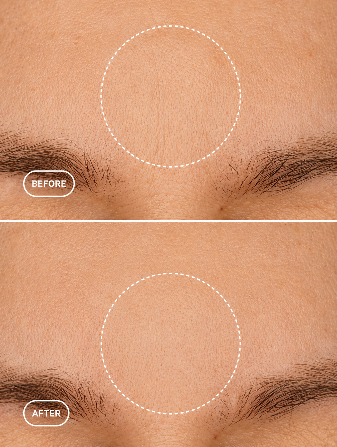 ELYO Retinol Alternative Cream
