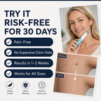 Så fungerar Skin Perfect — bandet stryper blodtillförseln och hudfliken faller av naturligt inom 1-2 veckor
