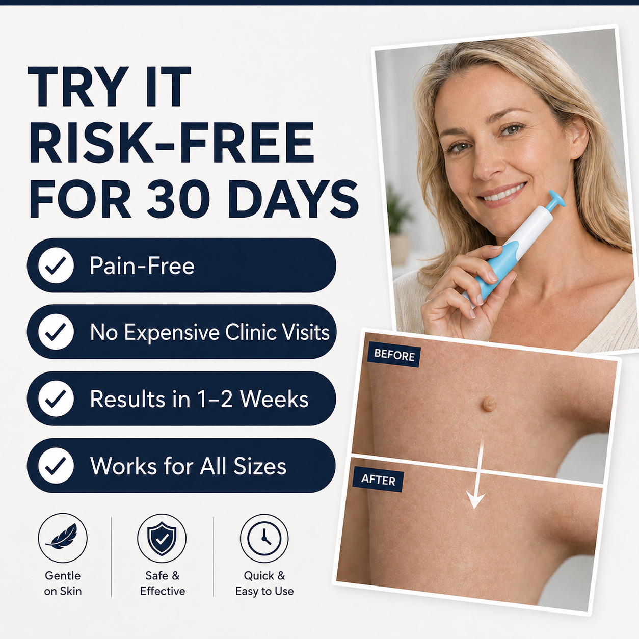 Så fungerar Skin Perfect — bandet stryper blodtillförseln och hudfliken faller av naturligt inom 1-2 veckor
