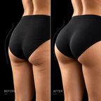 ELYO Sculpt Shorts™ – EMS Träningsshorts för Rumpa, Mage & Lår